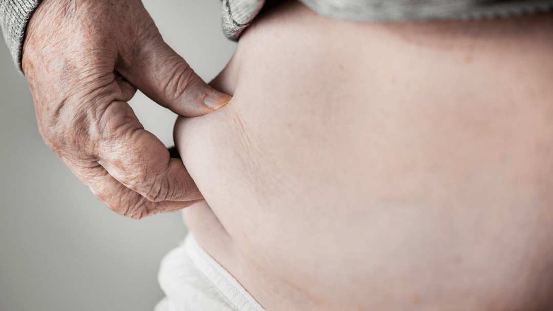 obesidad-en-personas-mayores